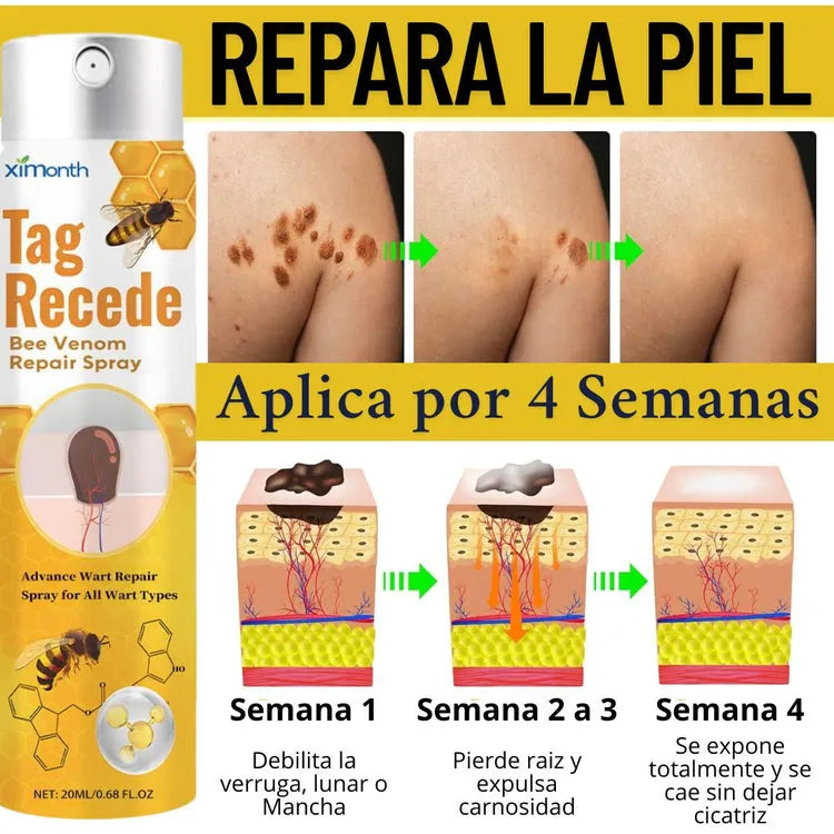 Eliminador de verrugas TagRecede™