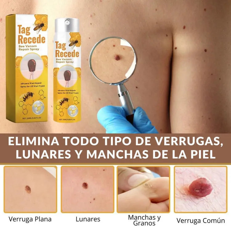 Eliminador de verrugas TagRecede™